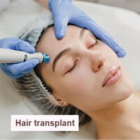 Hair-transplant