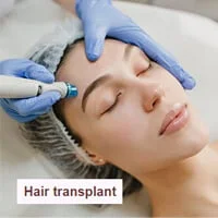 Hair-transplant