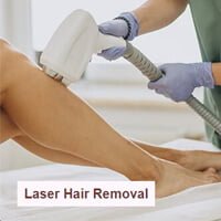 Laser-hair-removal