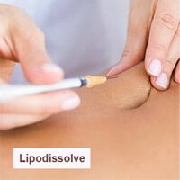 Lipodissolve