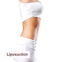 Liposuction
