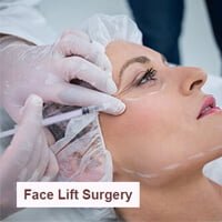 facelift-surgery