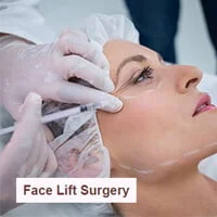 facelift-surgery