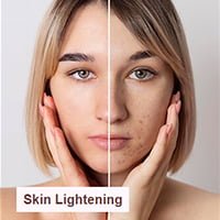 skin-lightening